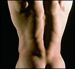 male liposuction