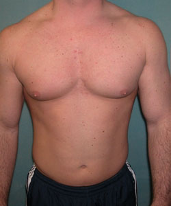 Adults (20-40) Before Photo Adults (20-40)