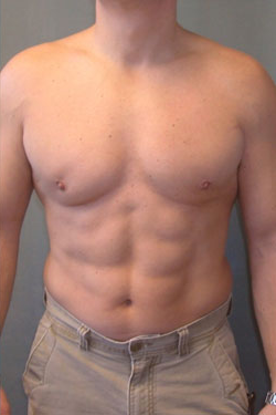 Adults (20-40) After Photo Adults (20-40)