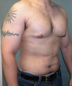 Adults (20-40) Before Photo Adults (20-40)