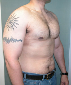 Adults (20-40) After Photo Adults (20-40)