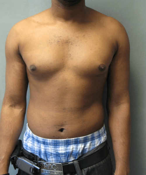Adults (20-40) Before Photo Adults (20-40)