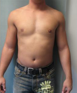 Adults (20-40) After Photo Adults (20-40)