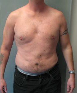 Adults (20-40) After Photo Adults (20-40)