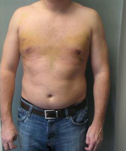 Adults (20-40) After Photo Adults (20-40)