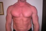 Gynecomastia Surgery for Bodybuilders
