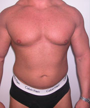 Combined Procedures Before Photo Combined Procedures