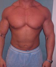 Combined Procedures After Photo Combined Procedures