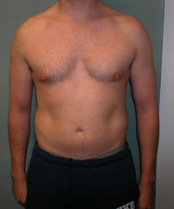 Combined Procedures Before Photo Combined Procedures
