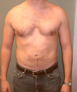 Combined Procedures After Photo Combined Procedures