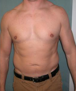 Combined Procedures After Photo Combined Procedures