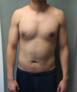 Combined Procedures After Photo Combined Procedures