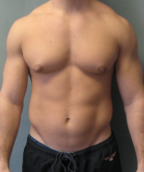 Bodybuilders Before Photo Bodybuilders