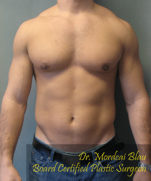 Bodybuilders After Photo Bodybuilders