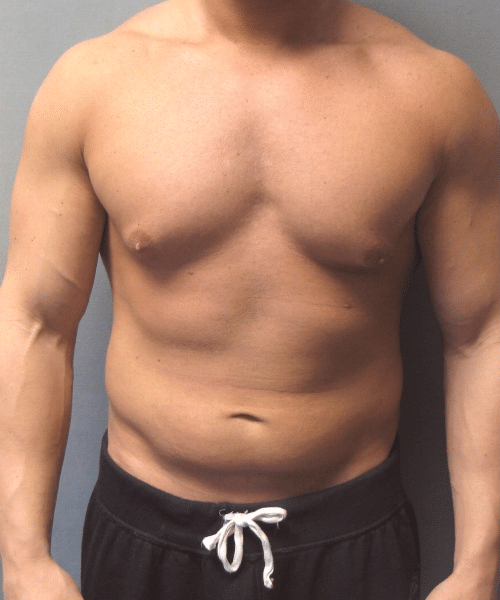 Bodybuilders Before Photo Bodybuilders