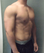 Gynecomastia Surgery for Bodybuilders
