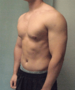 Gynecomastia Surgery for Bodybuilders