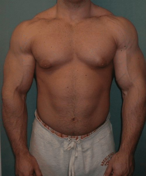 Bodybuilders Before Photo Bodybuilders