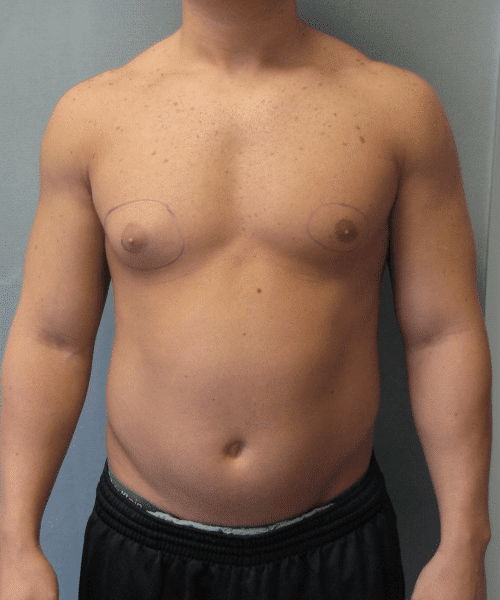 Bodybuilders Before Photo Bodybuilders