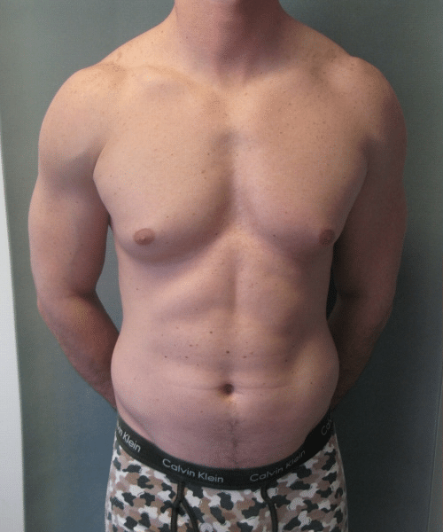 Bodybuilders Before Photo Bodybuilders