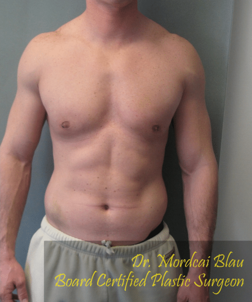Bodybuilders After Photo Bodybuilders