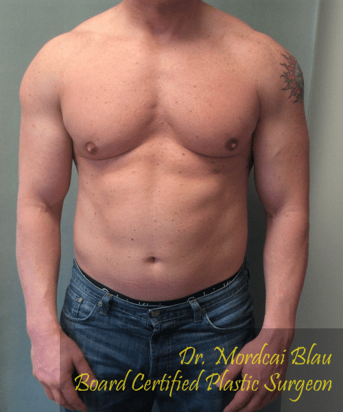 Bodybuilders After Photo Bodybuilders