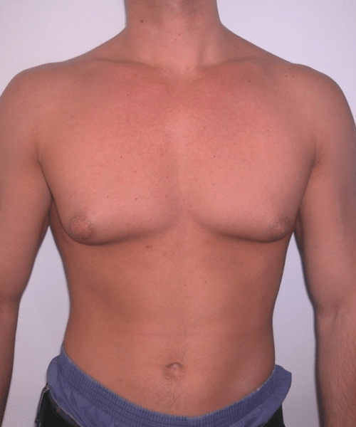 Adults (20-40) Before Photo Adults (20-40)