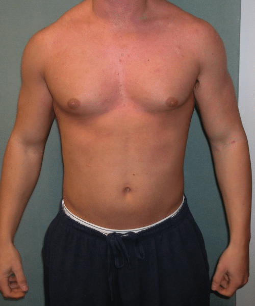Adults (20-40) Before Photo Adults (20-40)