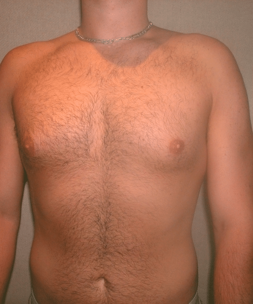 Adults (20-40) Before Photo Adults (20-40)