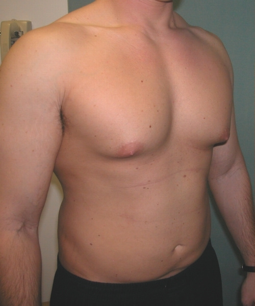 Adults (20-40)
