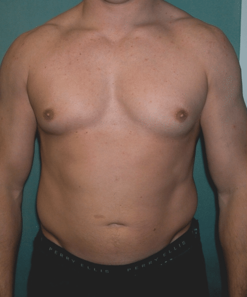 Adults (20-40) Before Photo Adults (20-40)