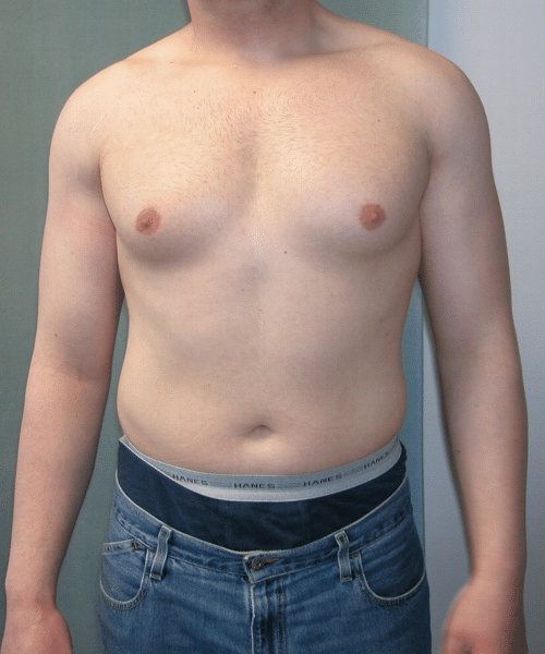 Adults (20-40) Before Photo Adults (20-40)