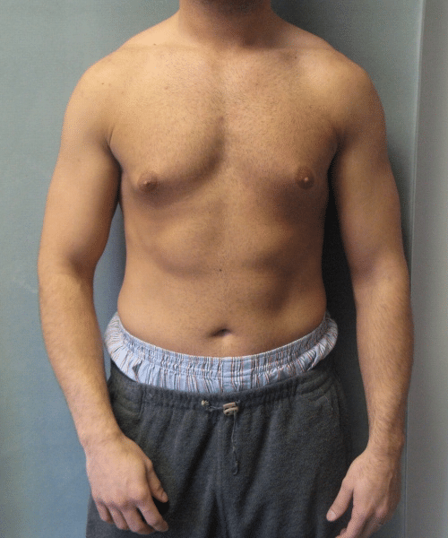 Adults (20-40) Before Photo Adults (20-40)