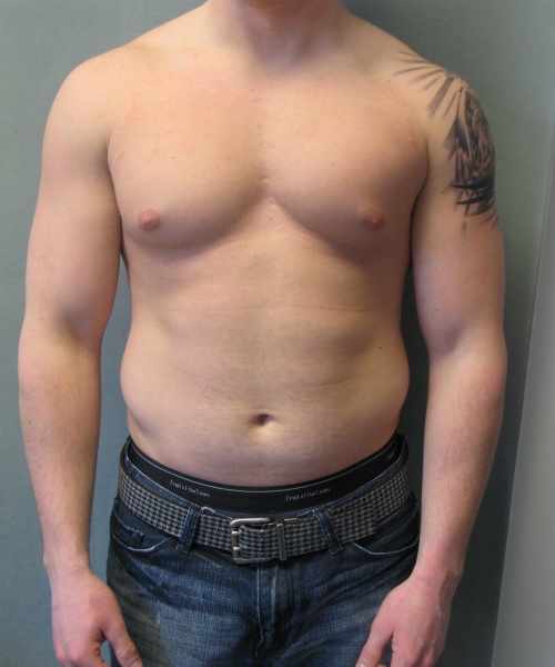 Adults (20-40) Before Photo Adults (20-40)