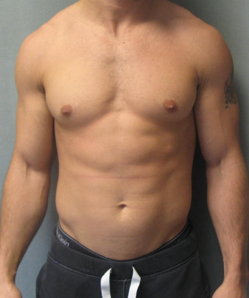 Adults (20-40) Before Photo Adults (20-40)