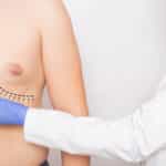 Understanding Teenage Gynecomastia: Causes, Treatment, and Support