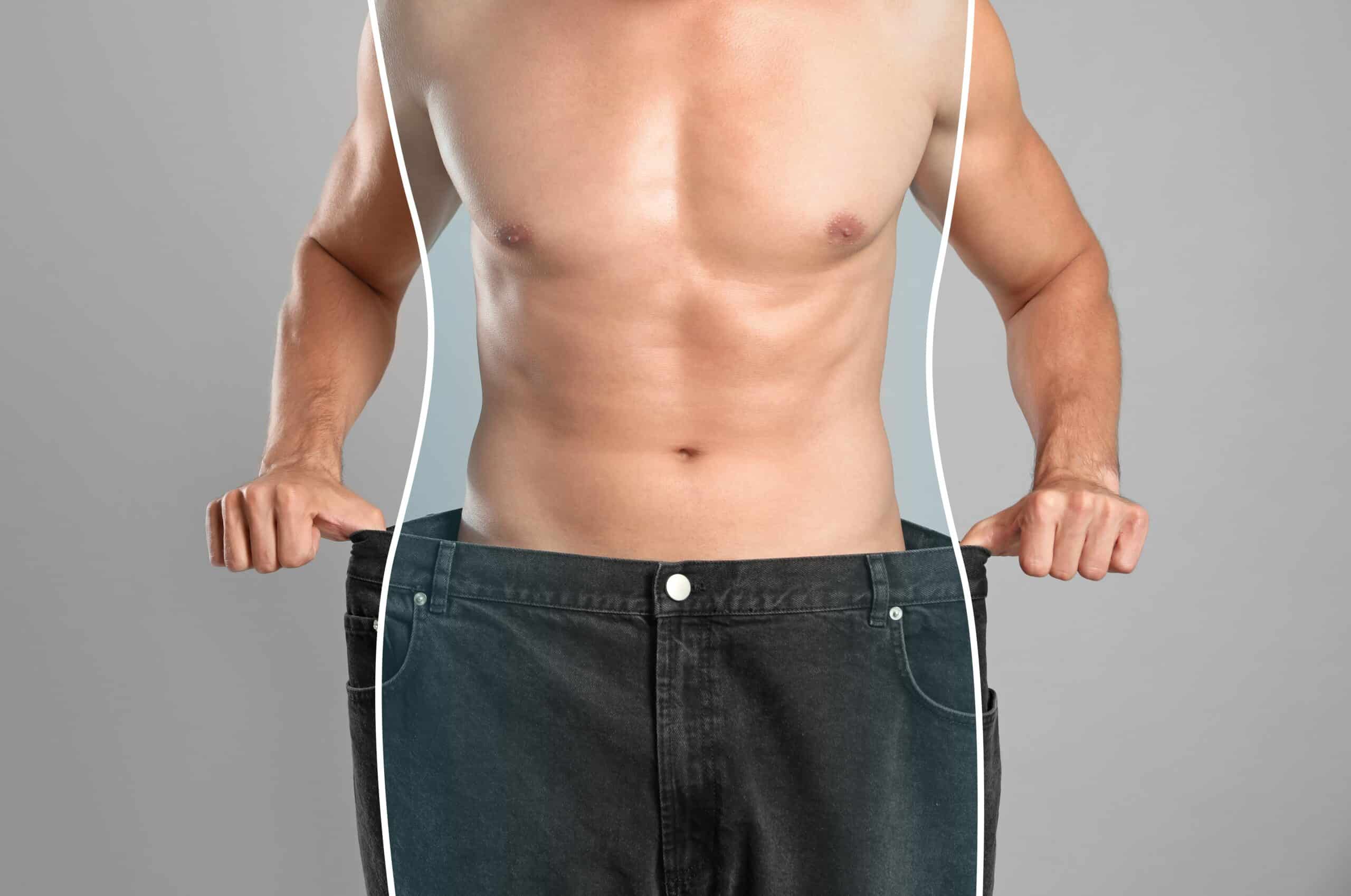 man after liposuction