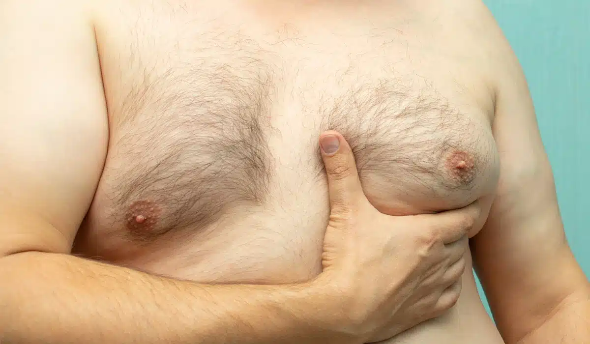 Close-up of an obese man's chest with a hand touching the breast area, illustrating gynecomastia or excess chest fat