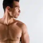 Does Gynecomastia Surgery Include Liposuction? White Plains, NY Surgeon Explains
