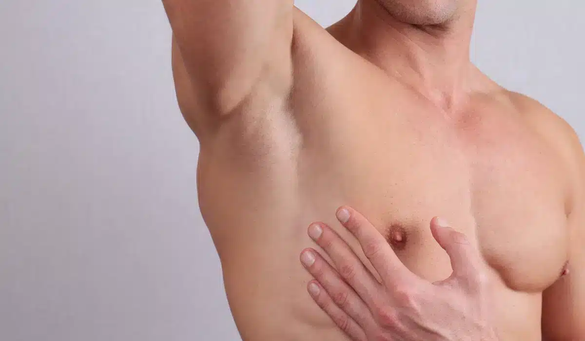 Why Gynecomastia Recurs: Common Causes & Prevention Tips in White Plains, NY