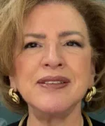 Facelift