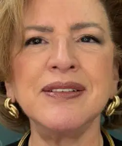 Facelift